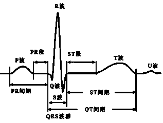 Automatic electrocardiogram recognition system