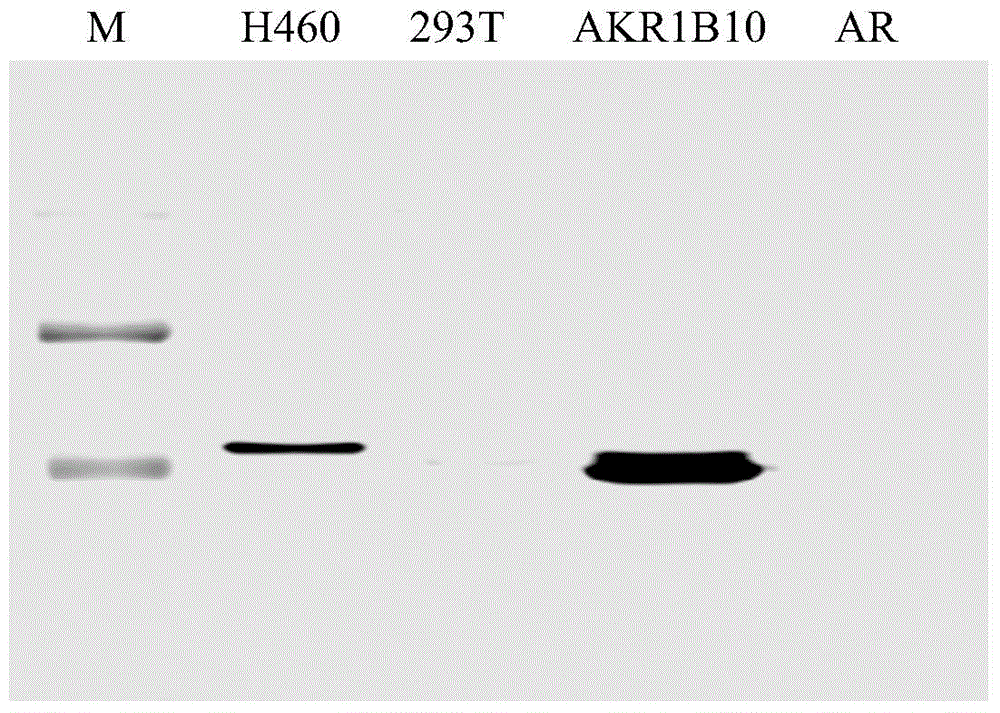 Anti-AKR1B10 protein monoclonal antibody and applications thereof