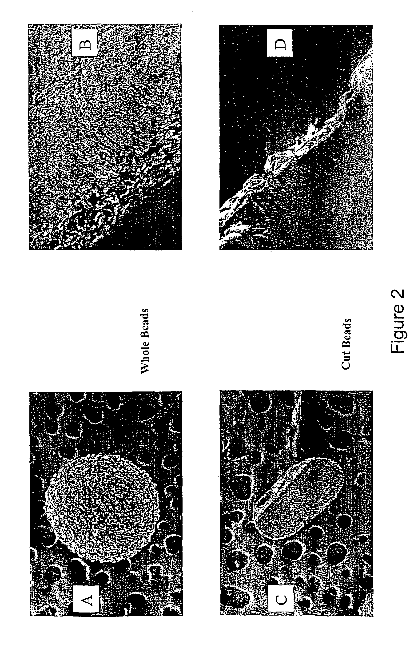 Galenic pectinate formulation for colon-targeted delivery of antibiotic-inactivating enzymes and method of use thereof