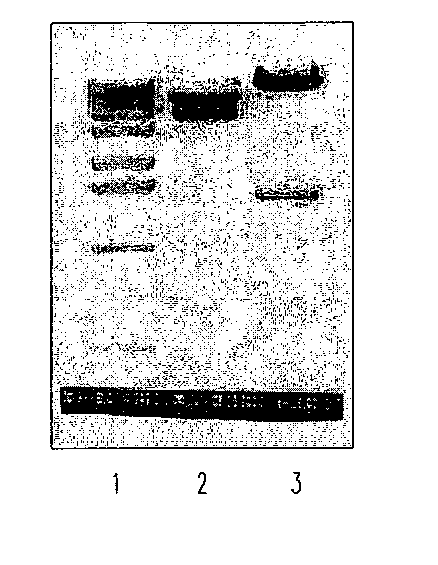Soluble fragments of the SARS-CoV spike glycoprotein