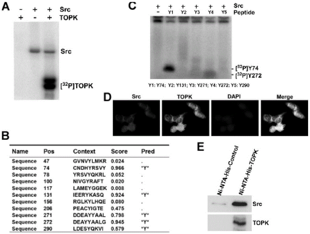 Anti-TOPK antibody with 74th tyrosine residue phosphorylated as well as preparation method and application of anti-TOPK antibody