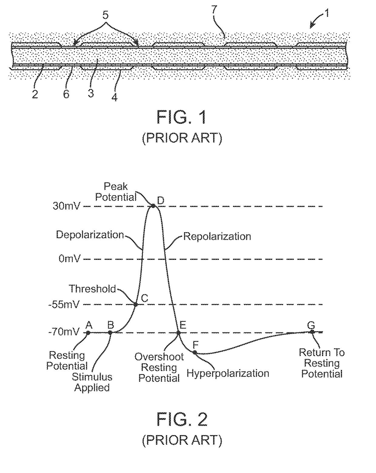 Method to enhance afferent and efferent transmission using noise resonance