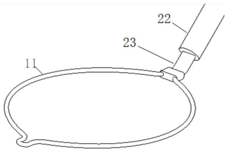 Lung metal marker detection device and system