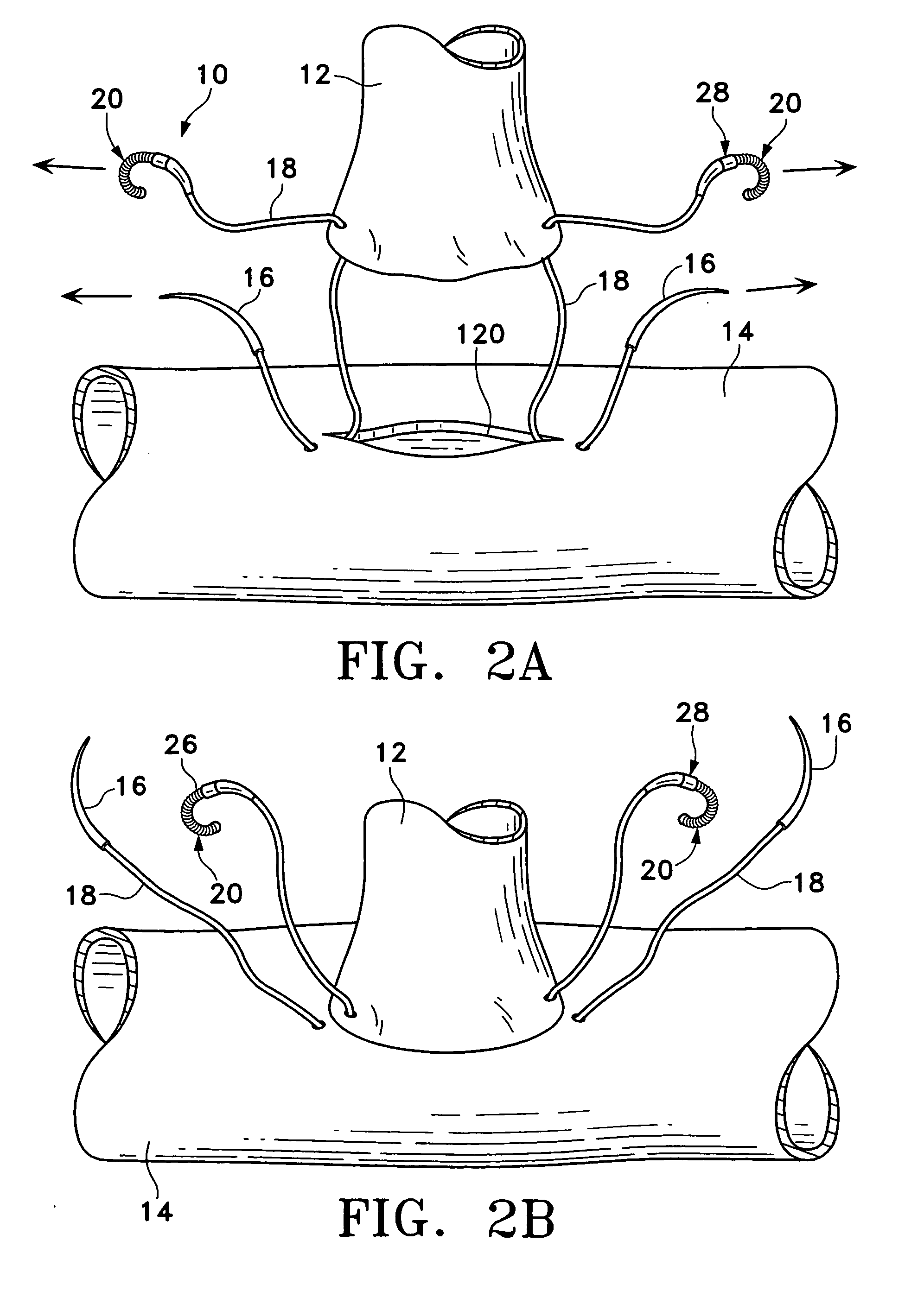 Tissue connector apparatus and methods