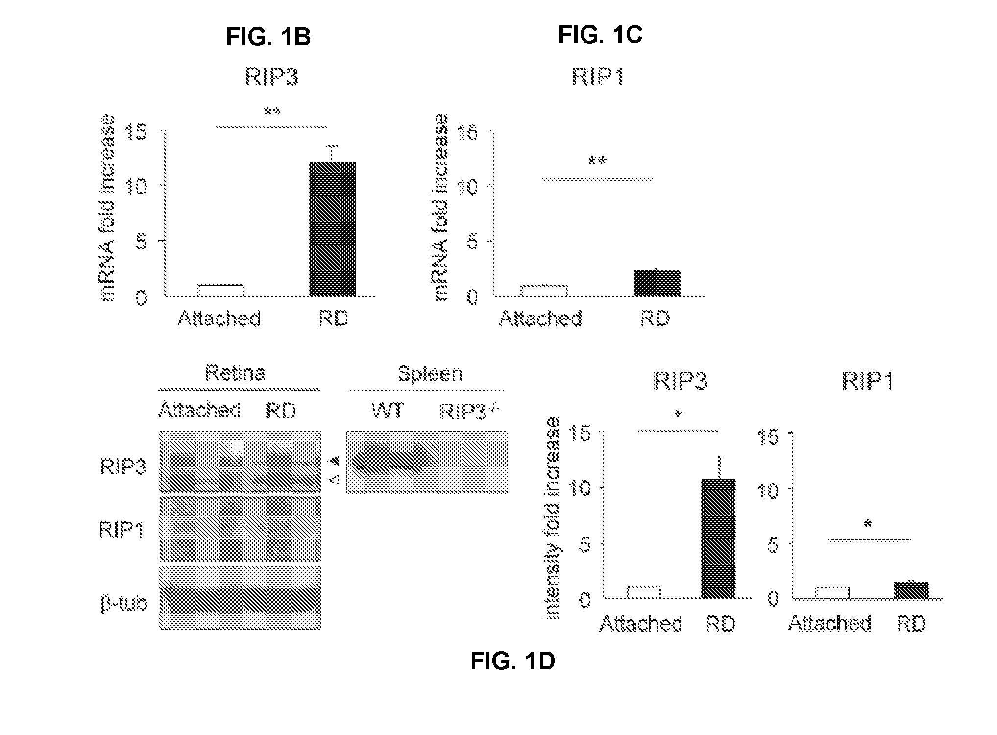 Methods and compositions for preserving photoreceptor and retinal pigment epithelial cells
