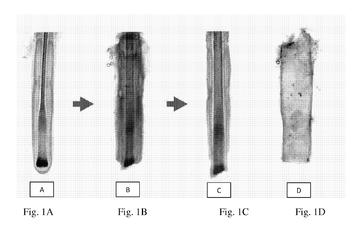 Compositions and methods for treating bone, joints and cartilage