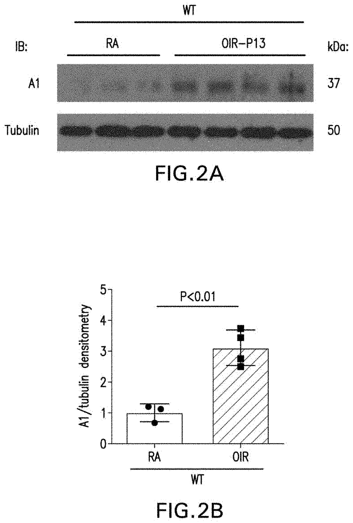 Compositions containing arginase 1 for the treatment of neurovascular and retinal vascular disorders