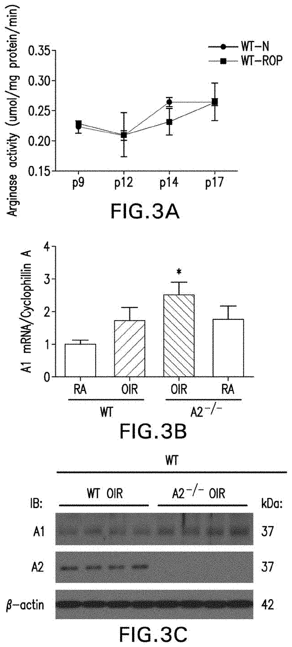 Compositions containing arginase 1 for the treatment of neurovascular and retinal vascular disorders