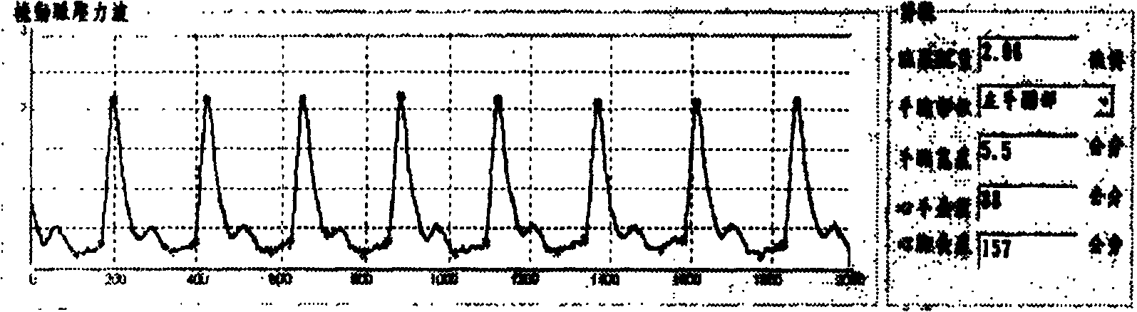 Instrumentation system and method for vein rib point