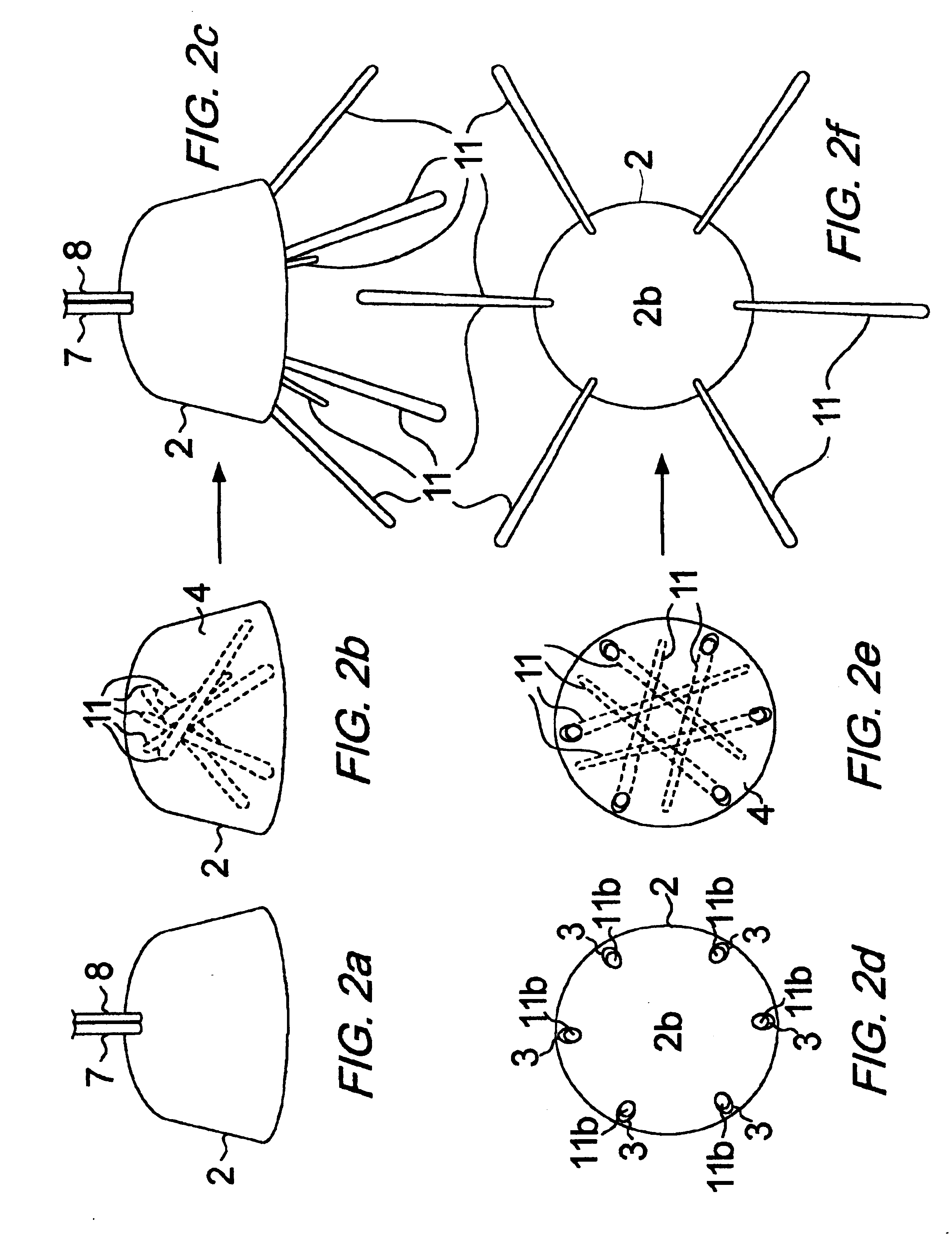 Anchoring systems and methods for anchoring an object