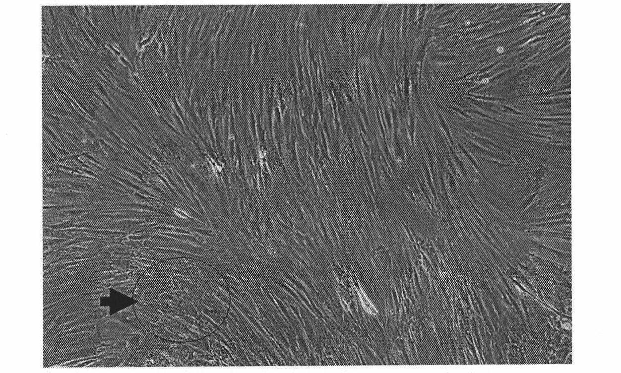 Human osteosarcoma cell strain and application thereof