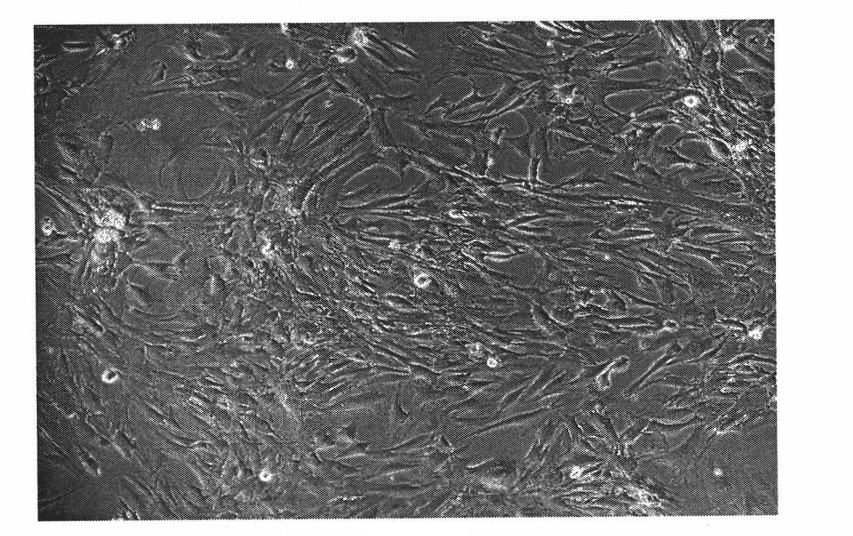 Human osteosarcoma cell strain and application thereof