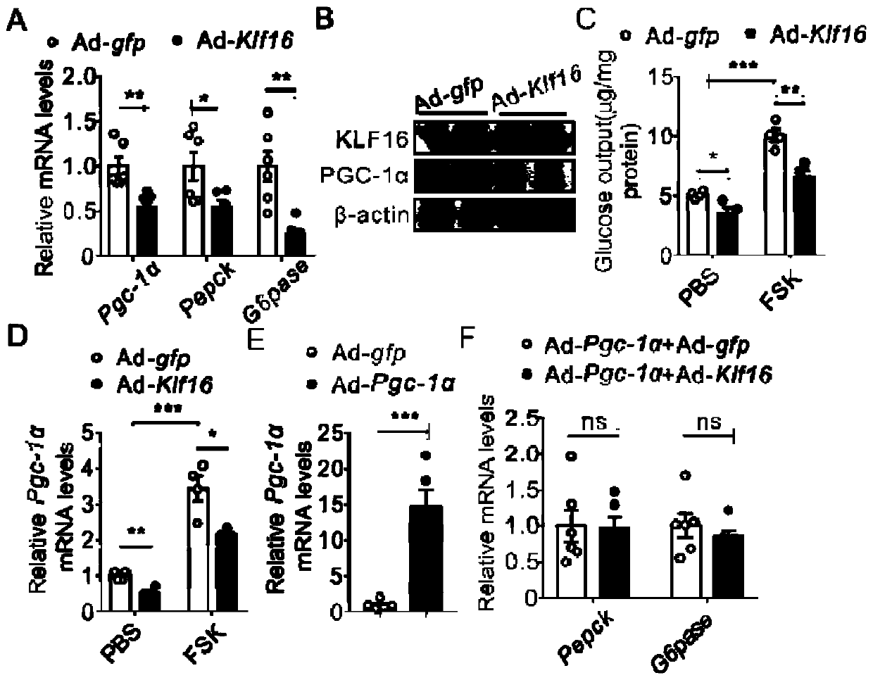 Application of transcription factor KLF16 protein in preparing drugs for preventing and treating diseases related to abnormal lipid and glucose metabolism