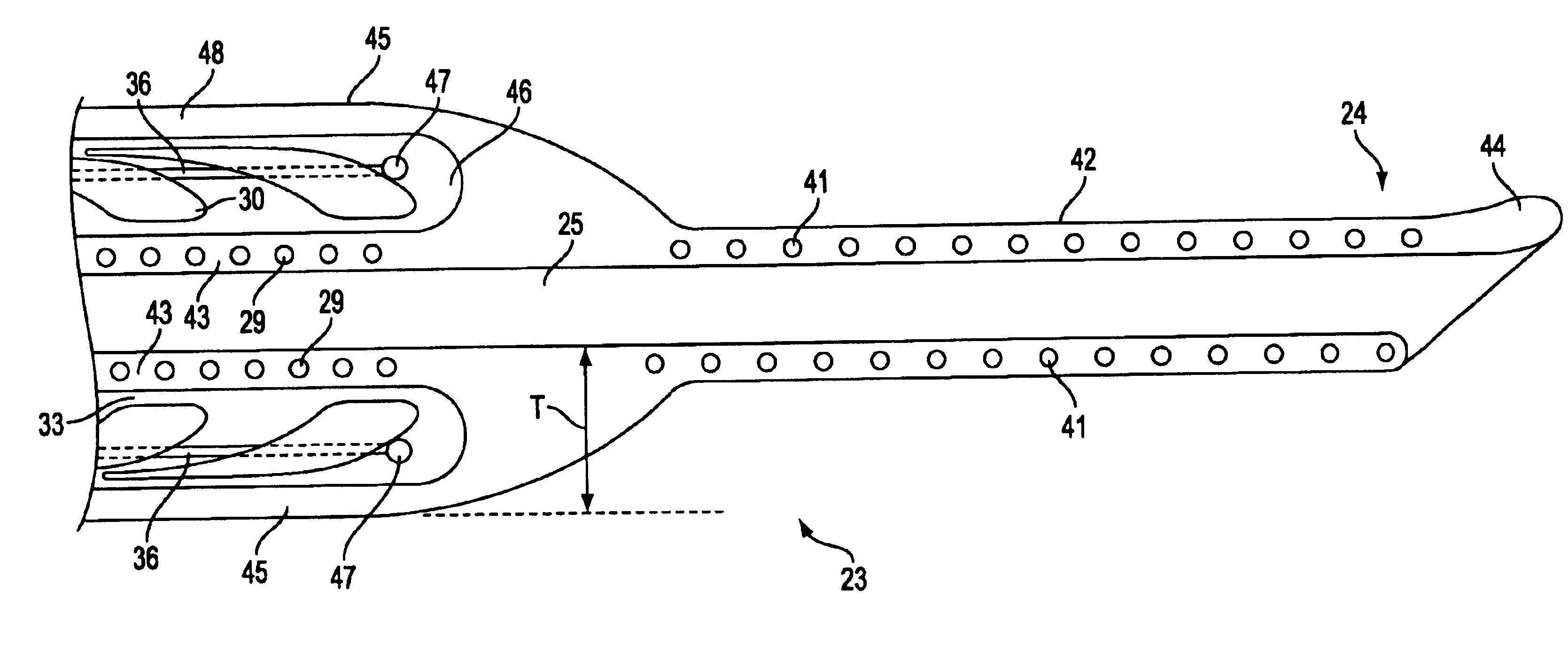 Shape lockable apparatus and method for advancing an instrument through unsupported anatomy