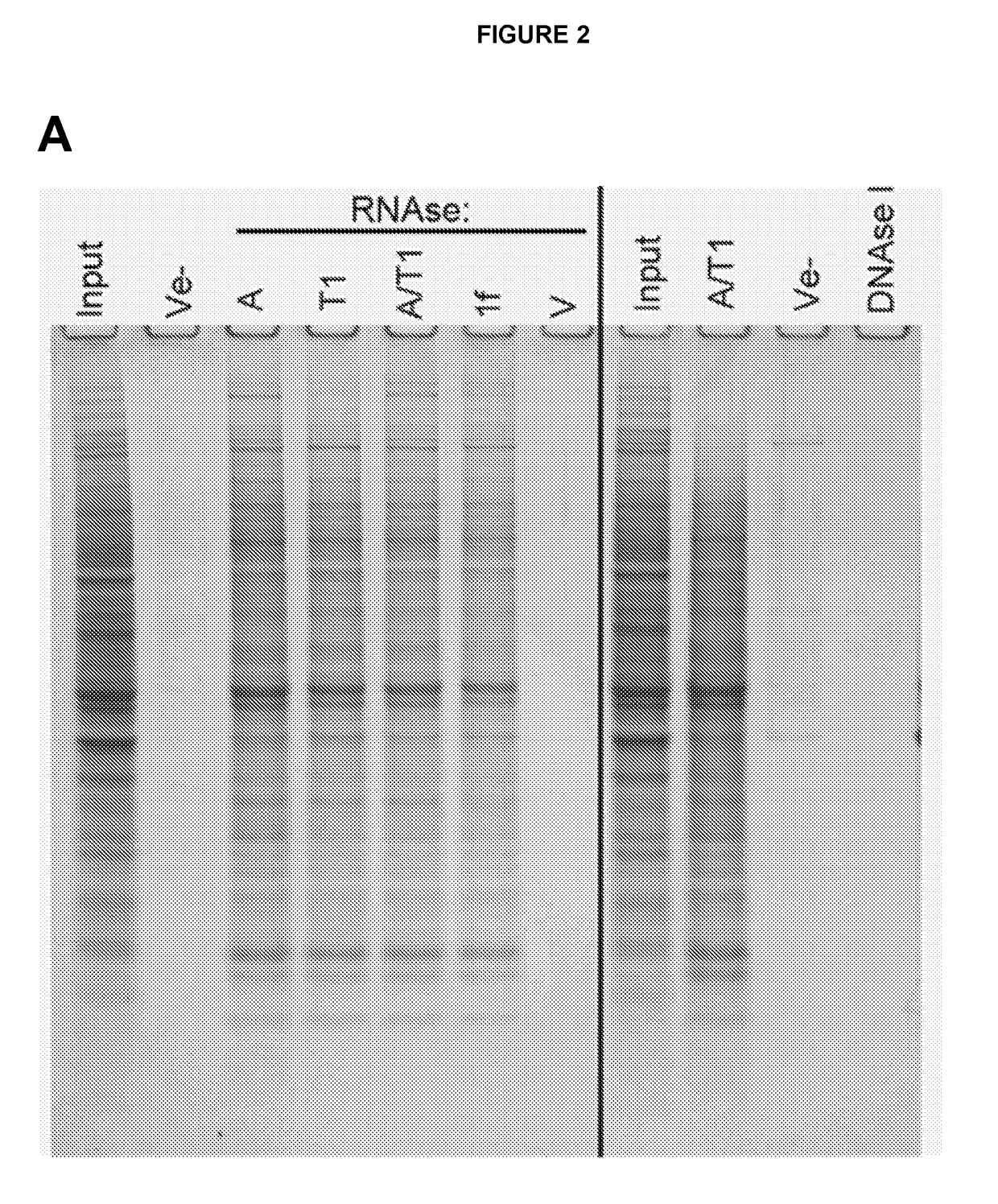 Method for Preventing or Treating a Protein Aggregation Disease