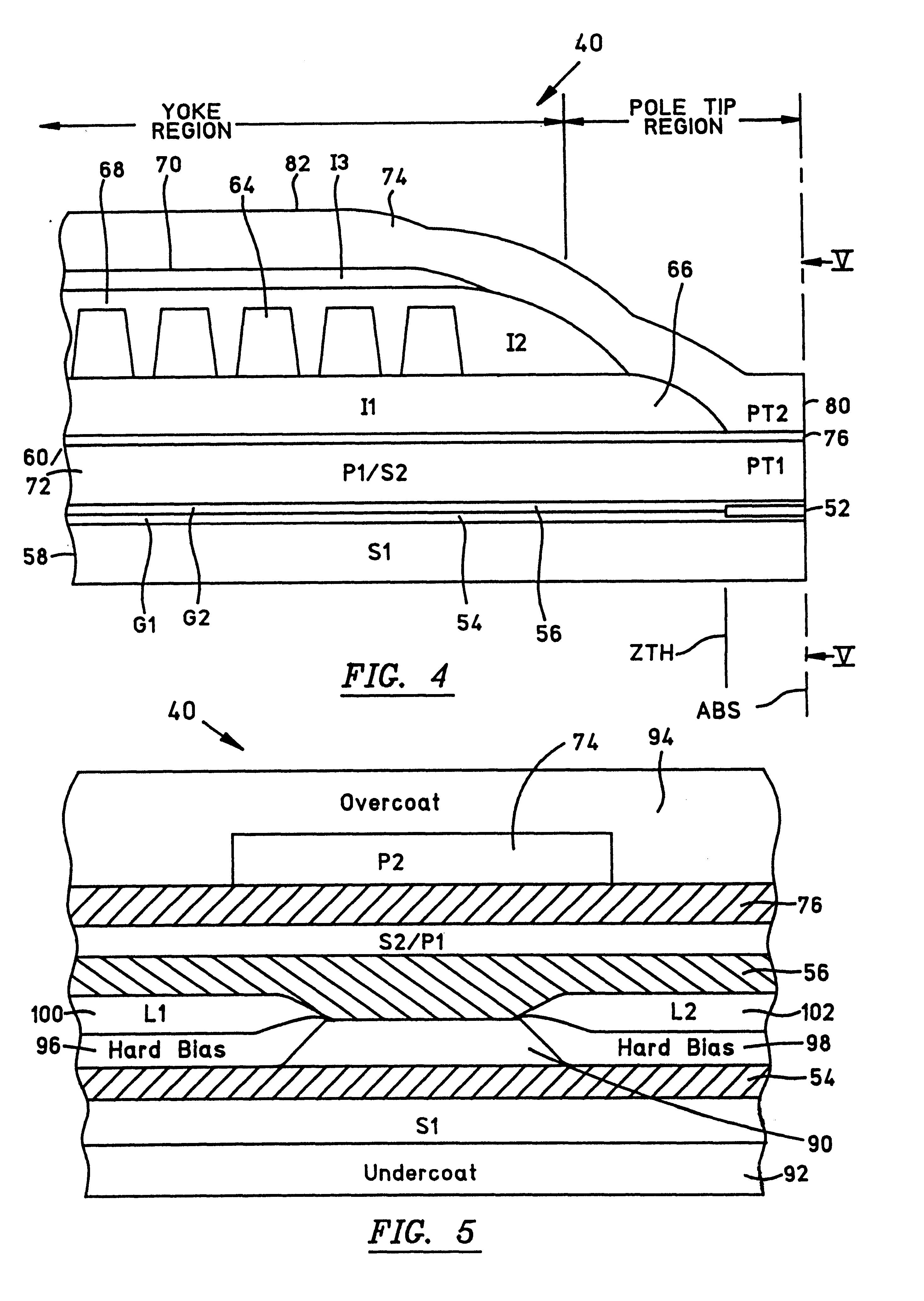 AMR Sensor with a soft adjacent layer having high magnetization, high resistivity, low intrinsic anisotropy and near zero magnetostriction