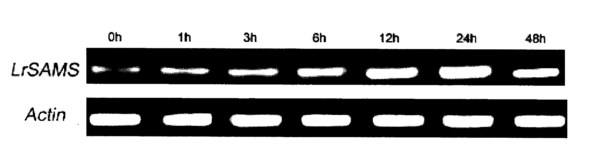 Short-tube lycoris S-adenosylmethionine synthetase and its coding gene and use