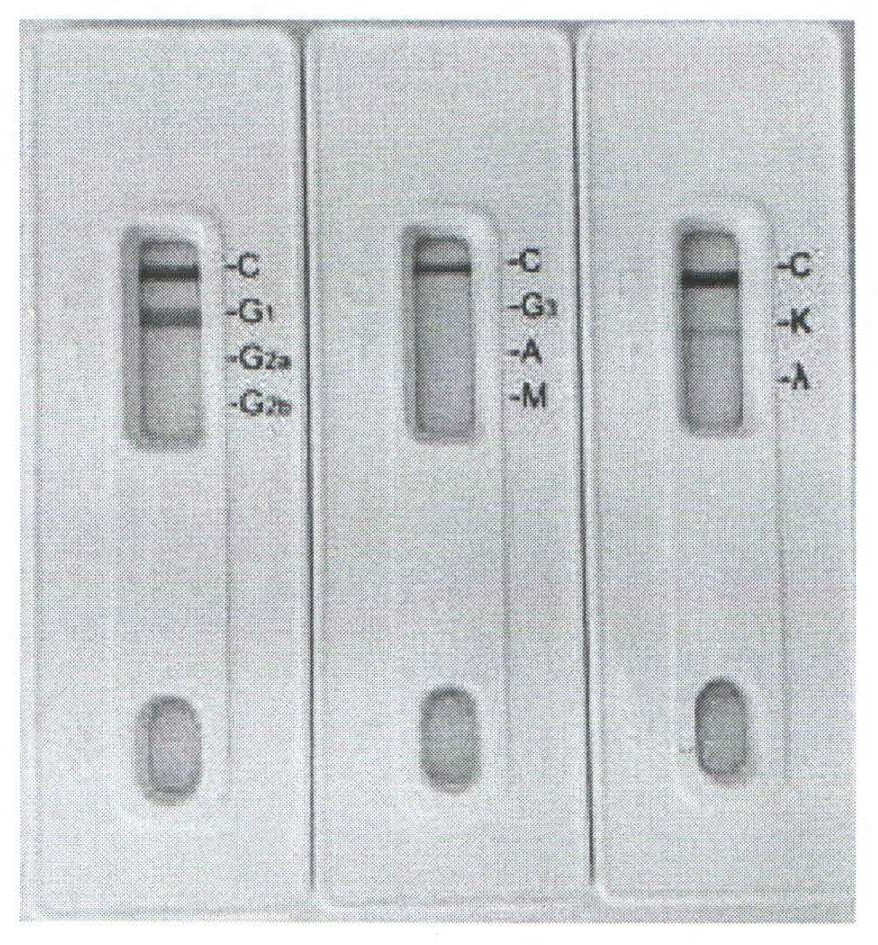 Preparation method and application of monoclonal antibody for resisting echinococcus multilocularis adult pellicle antigen