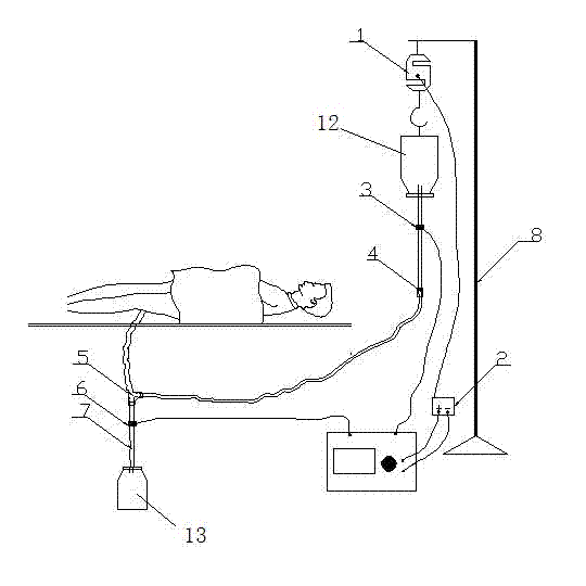 Full-automatic bladder irrigation device