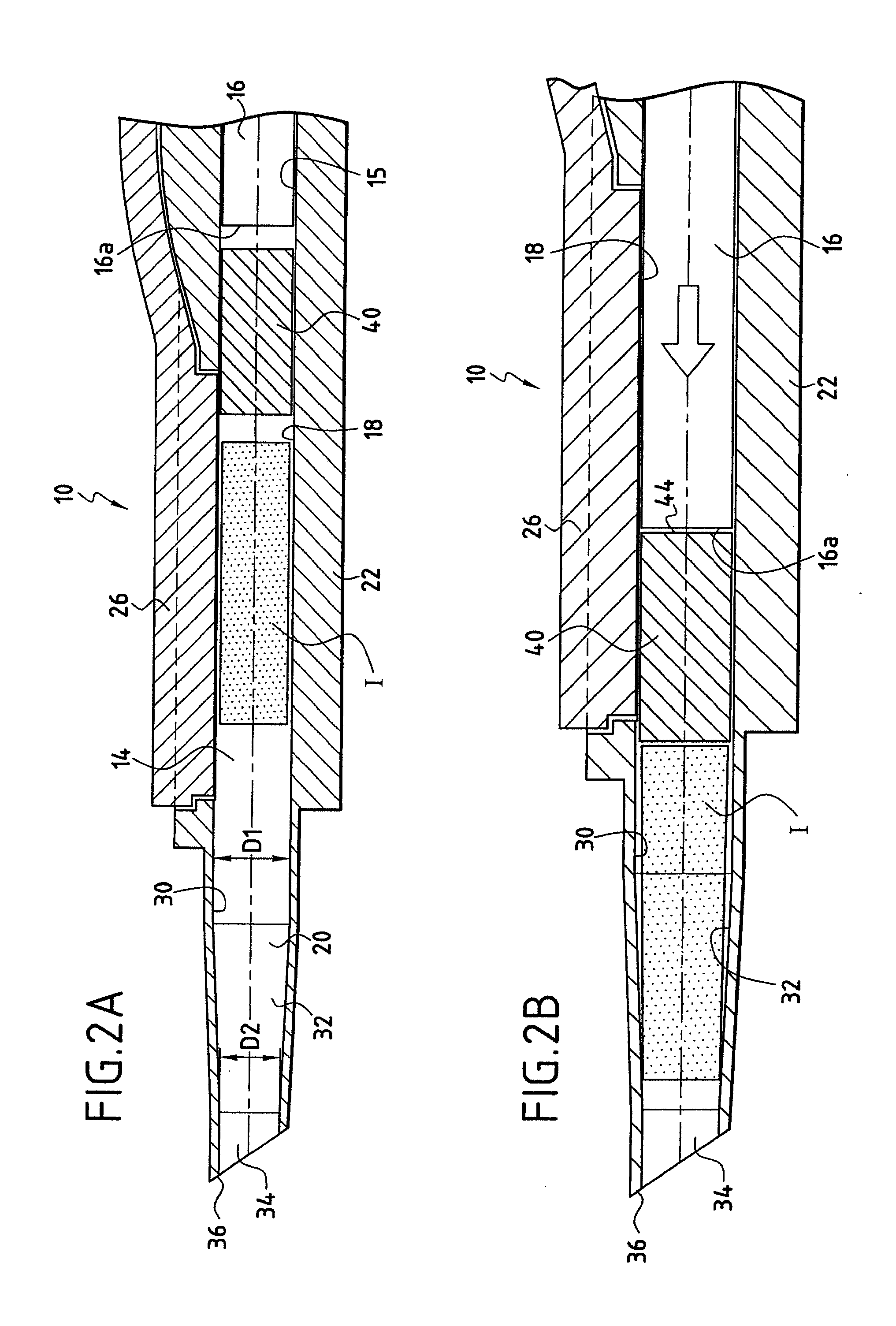 Flexible intraocular implant injector