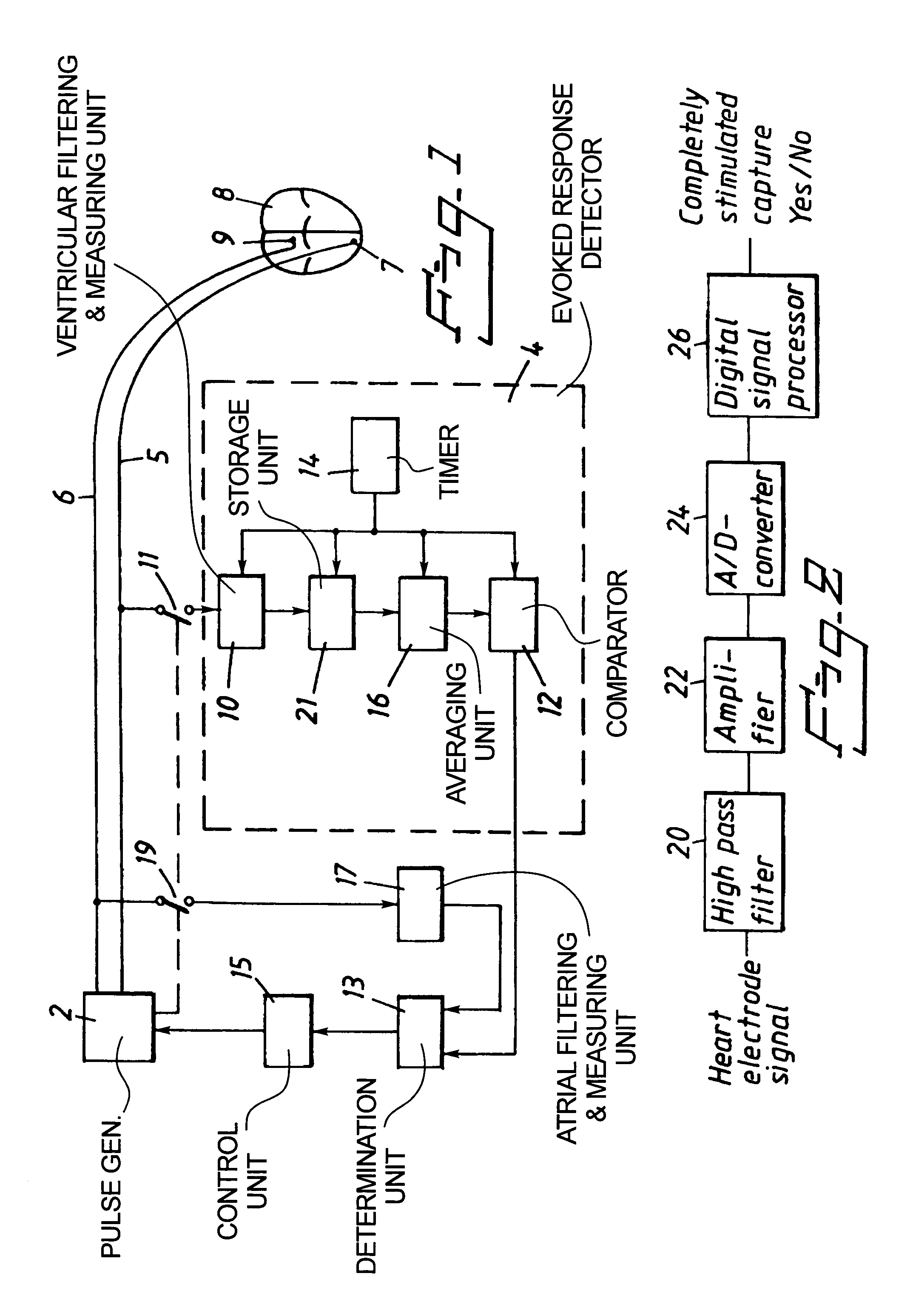 Dual chamber heart stimulator with evoked response detector