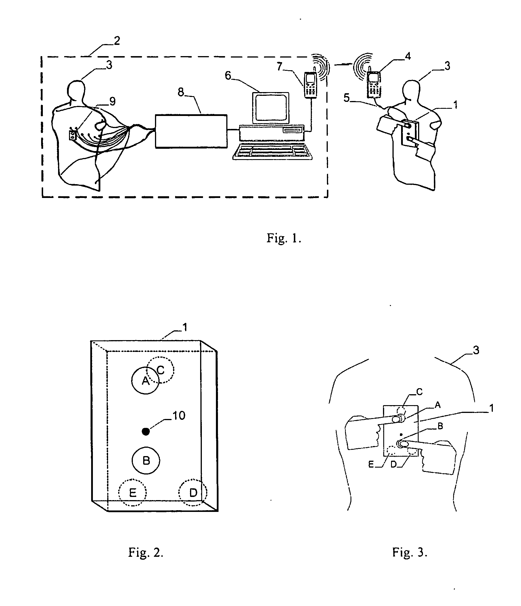 Apparatus and method for cordless recording and telecommunication transmission of three special ecg leads and their processing