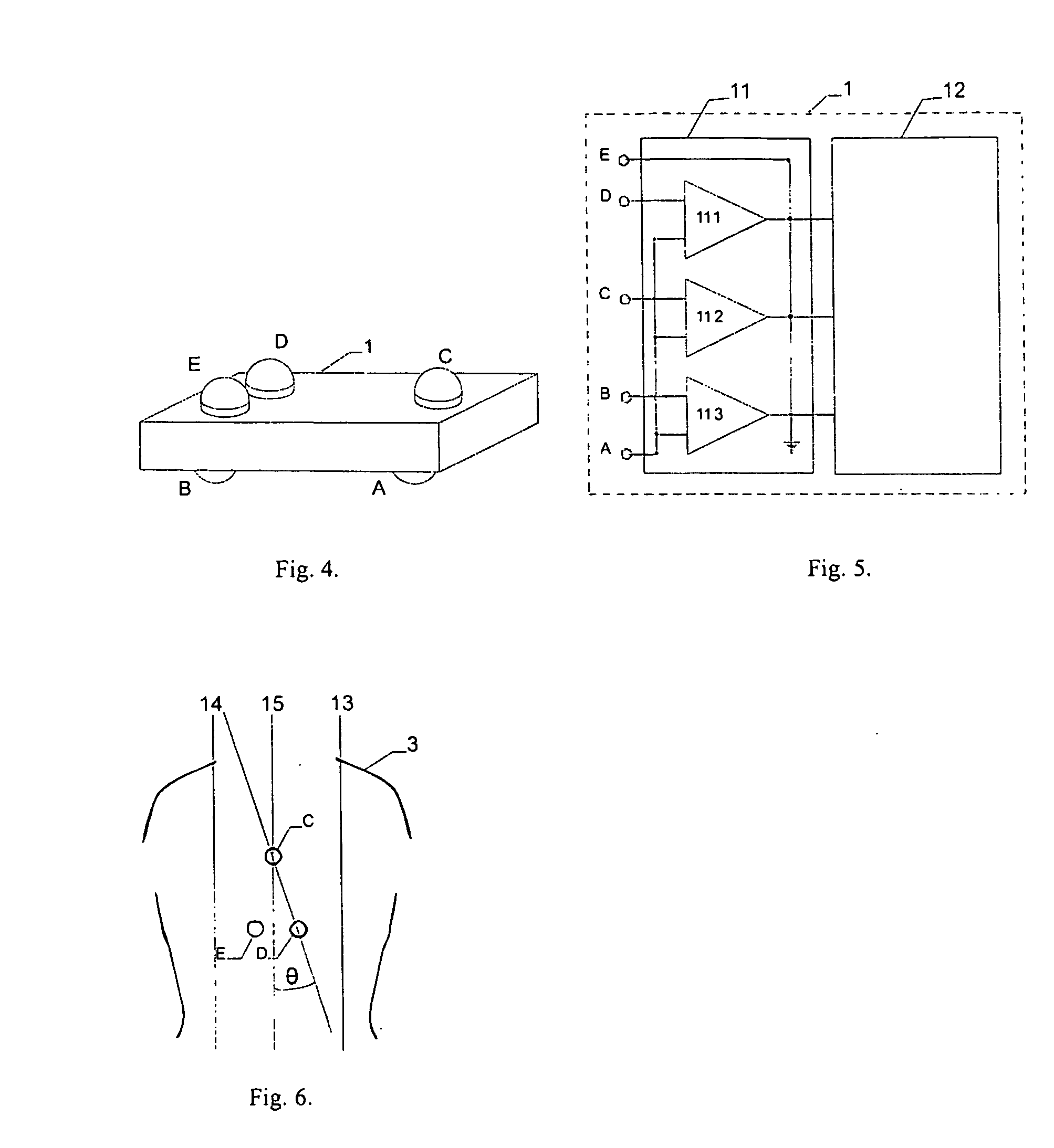 Apparatus and method for cordless recording and telecommunication transmission of three special ecg leads and their processing