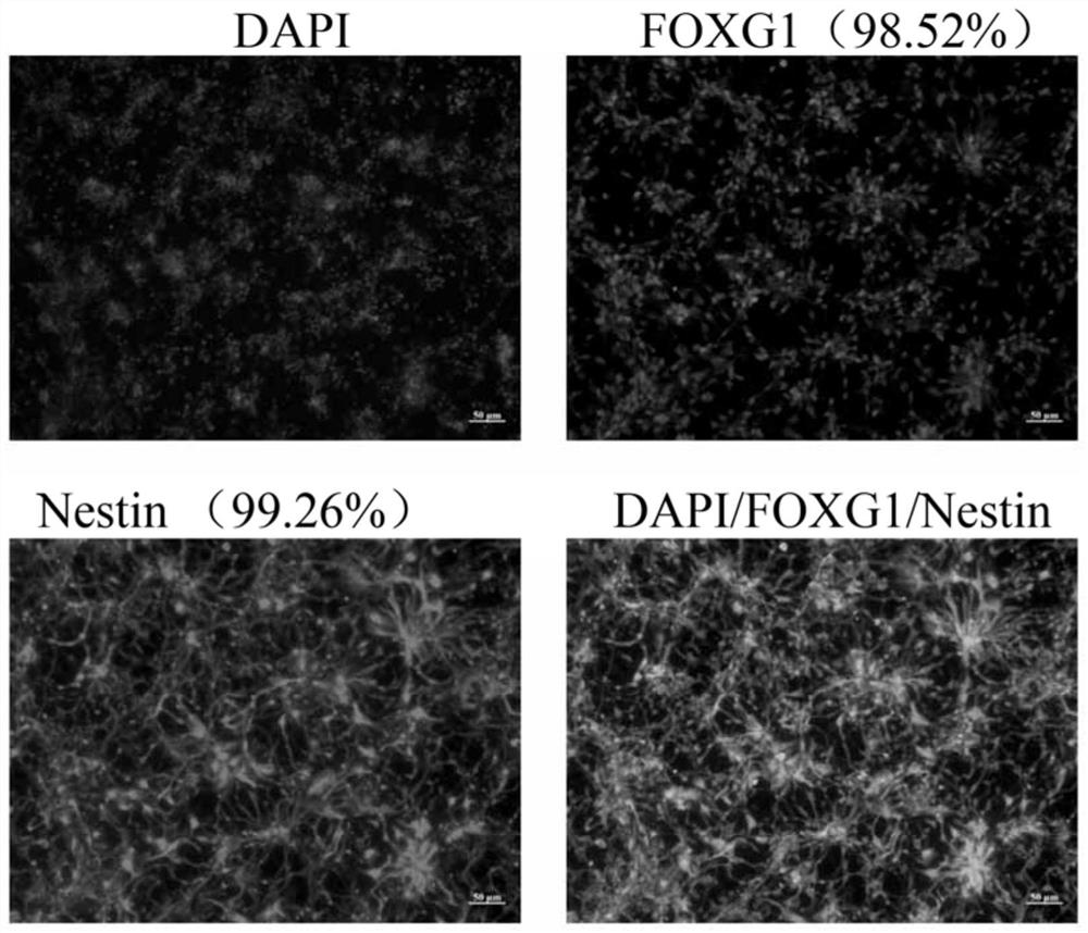 generation-of-neural-precursor-cells-from-embryonic-stem-cells-or