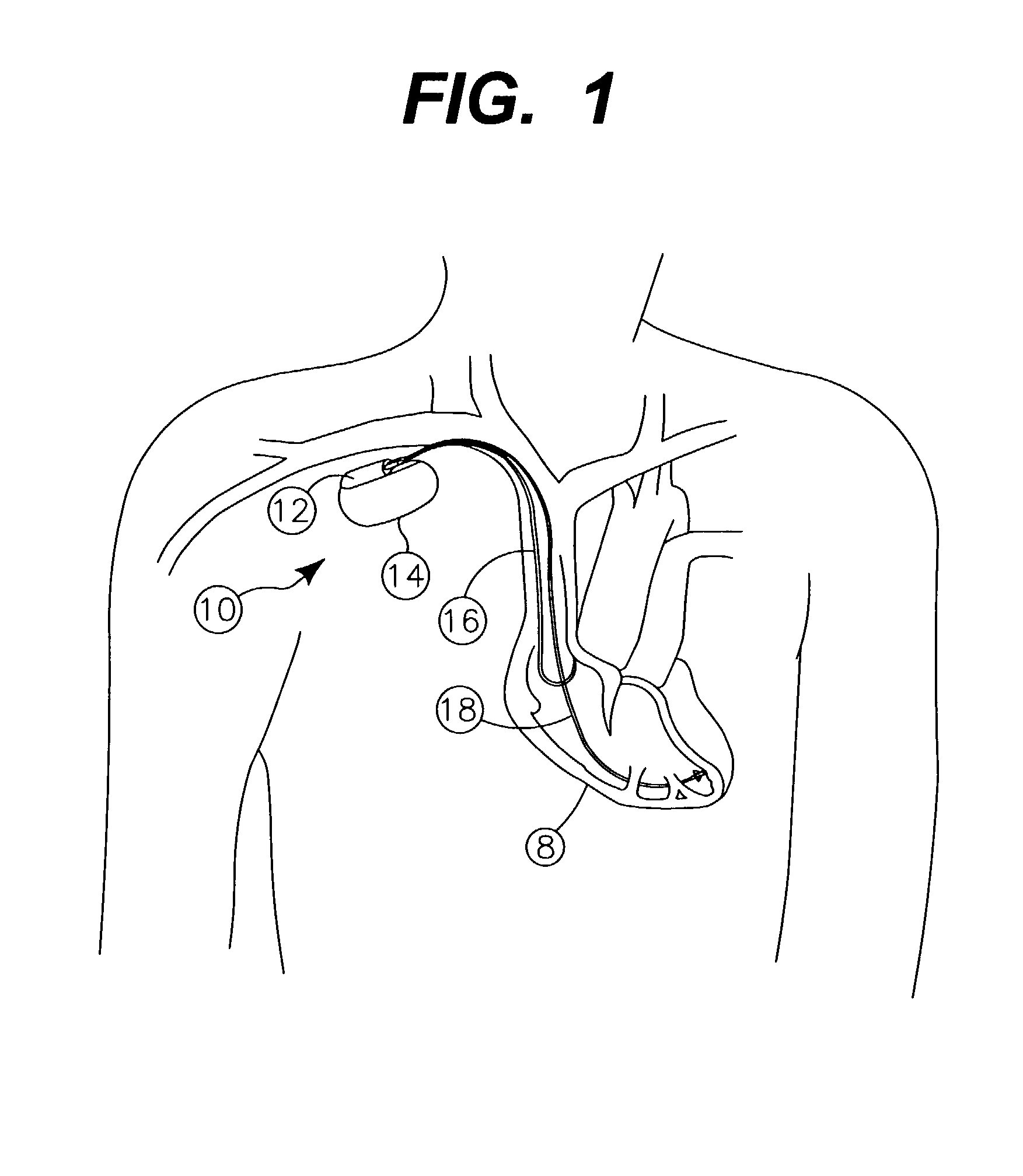 Method and system for determining kidney failure