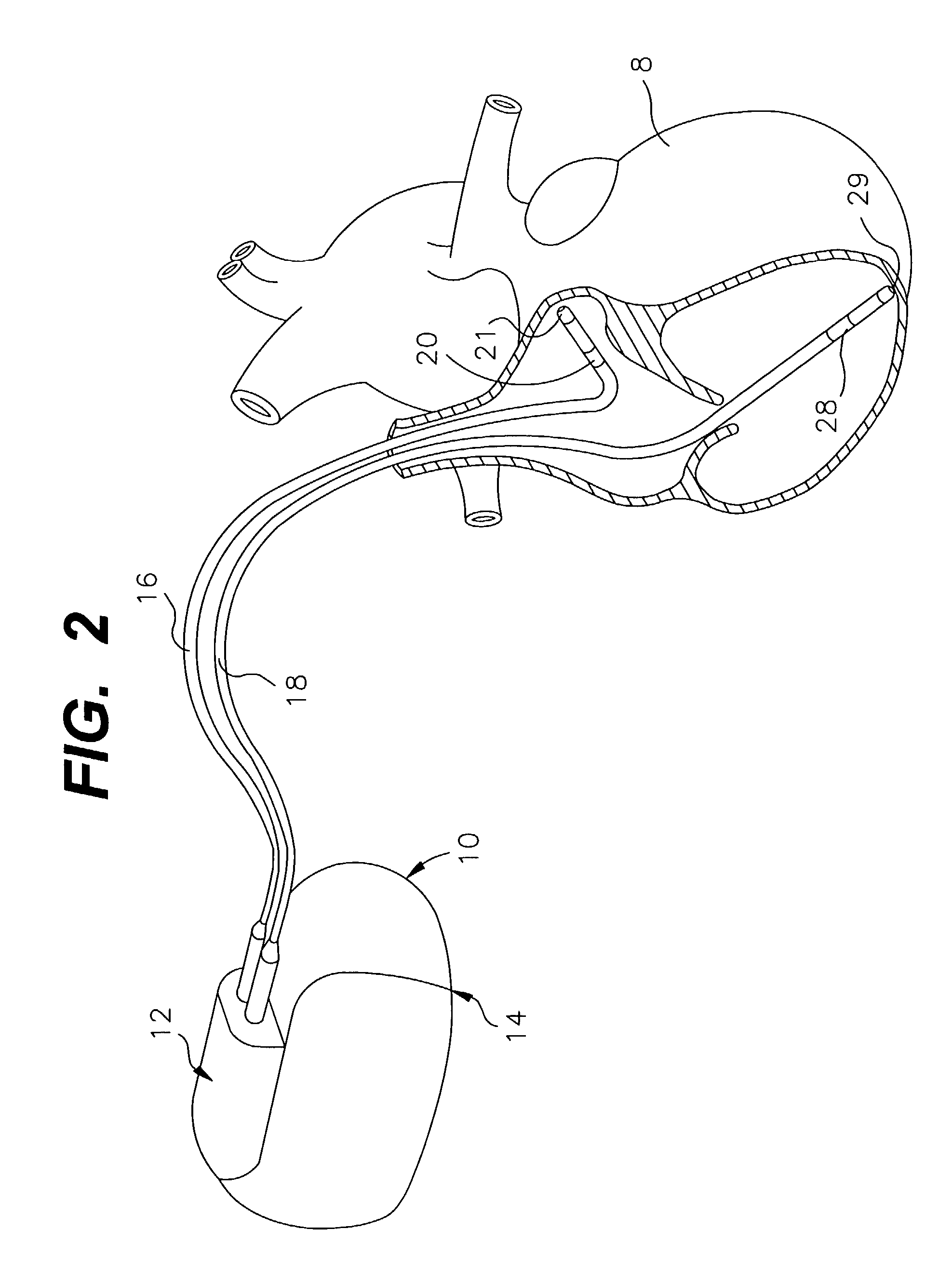 Method and system for determining kidney failure