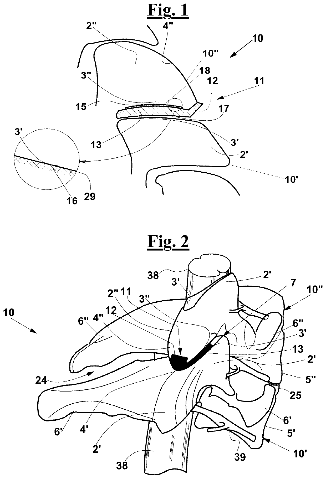 Partial endoprosthesis device for a vertebral joint