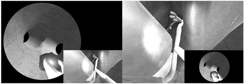 Virtual laparoscopic common bile duct exploration training method and system