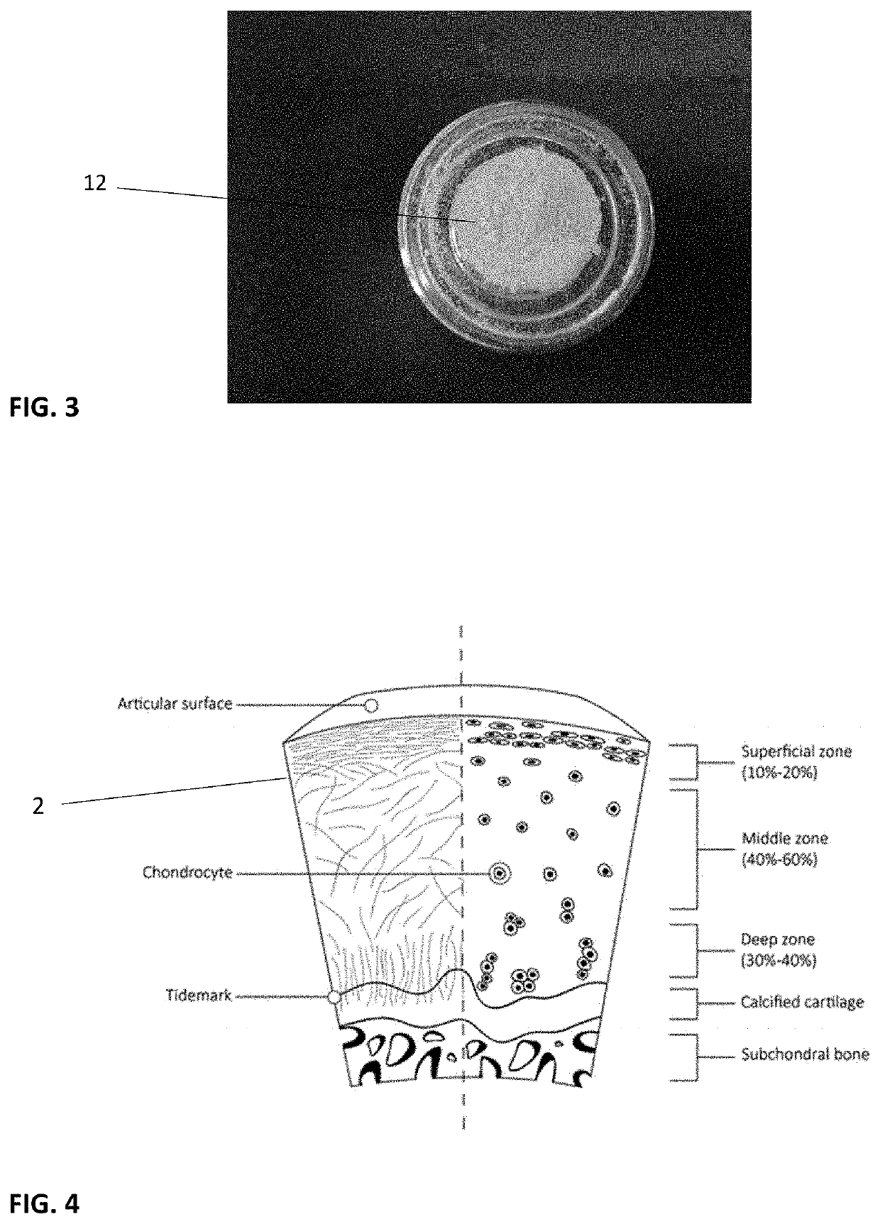 Infused cartilage fibers