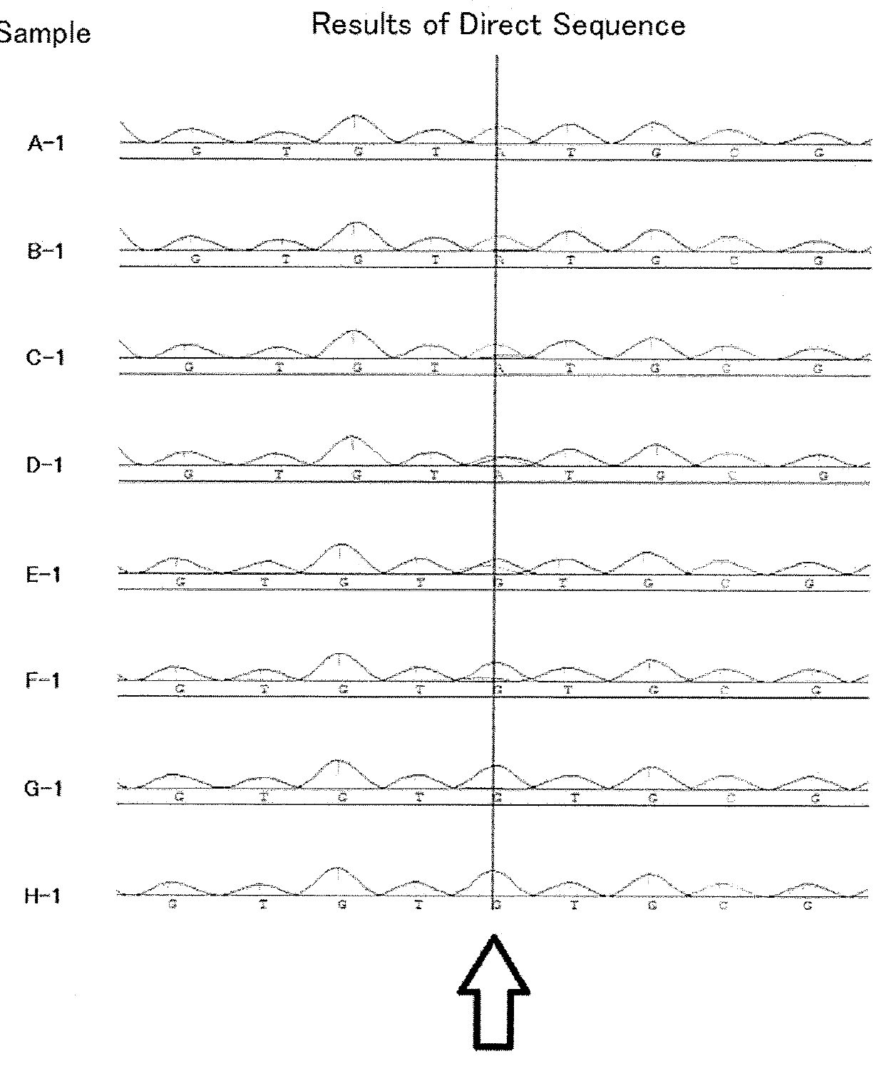 Detection method for mutation in 93rd amino acid of hepatitis c virus ns5a protein, and detection kit for mutation in 93rd amino acid of hepatitis c virus ns5a protein