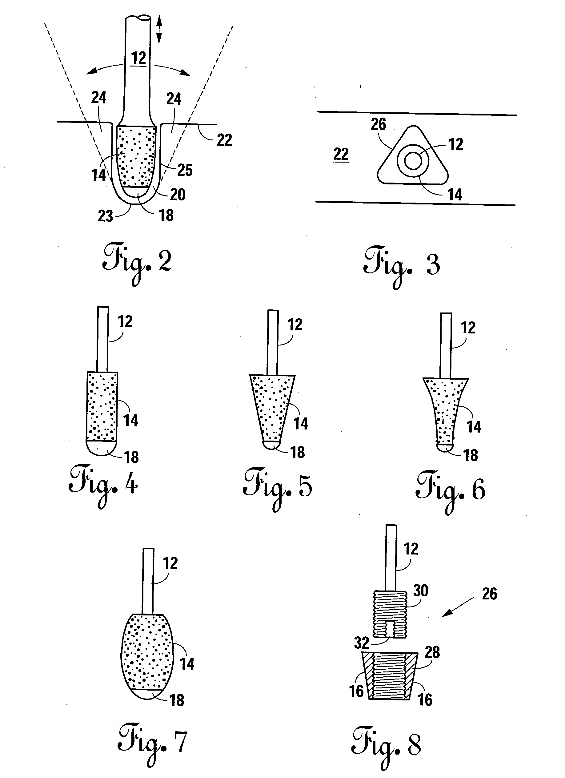 Methods and Apparatus for Preparing a Dental Implant Site