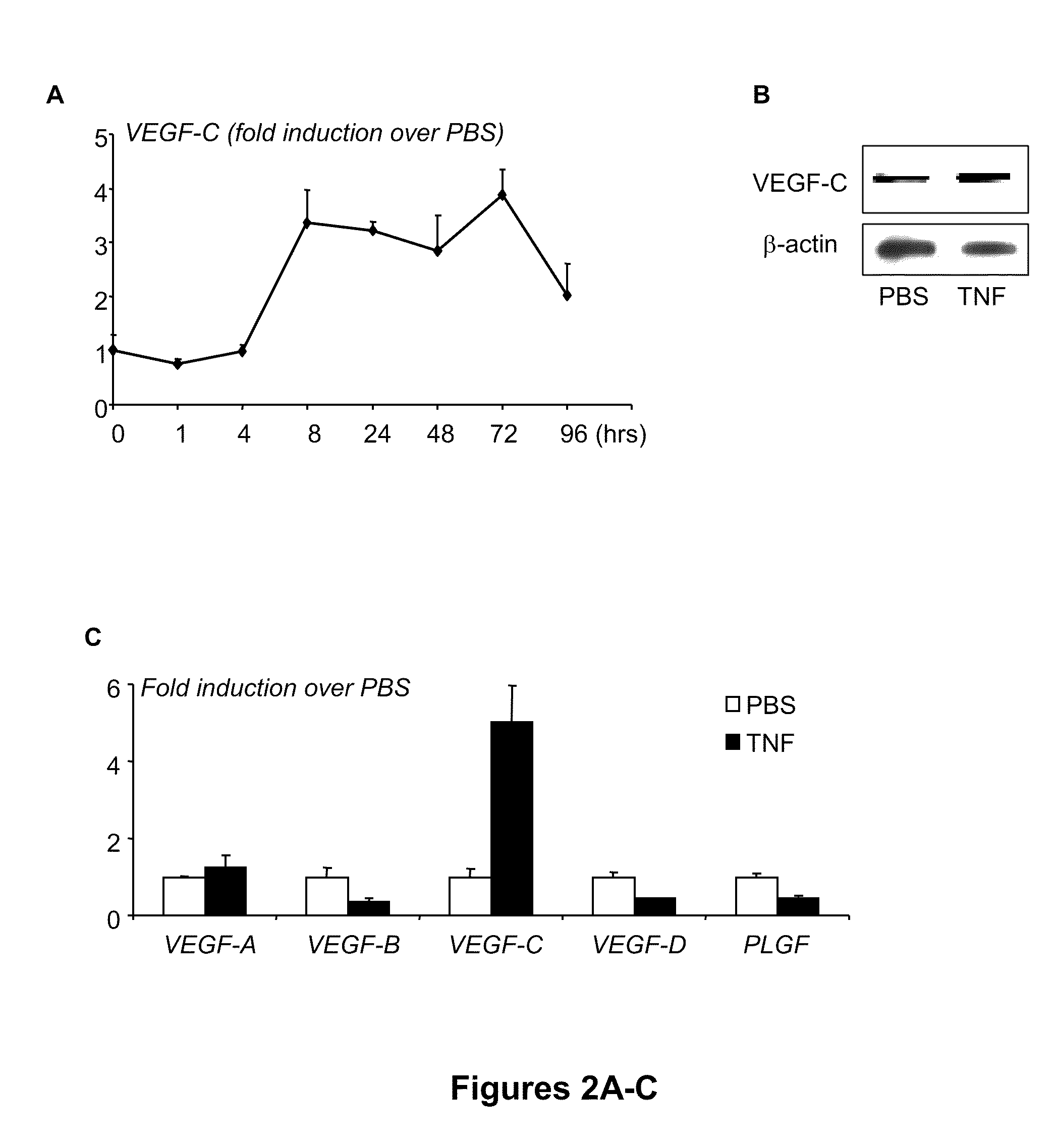 Methods and compositions for treating inflammatory conditions