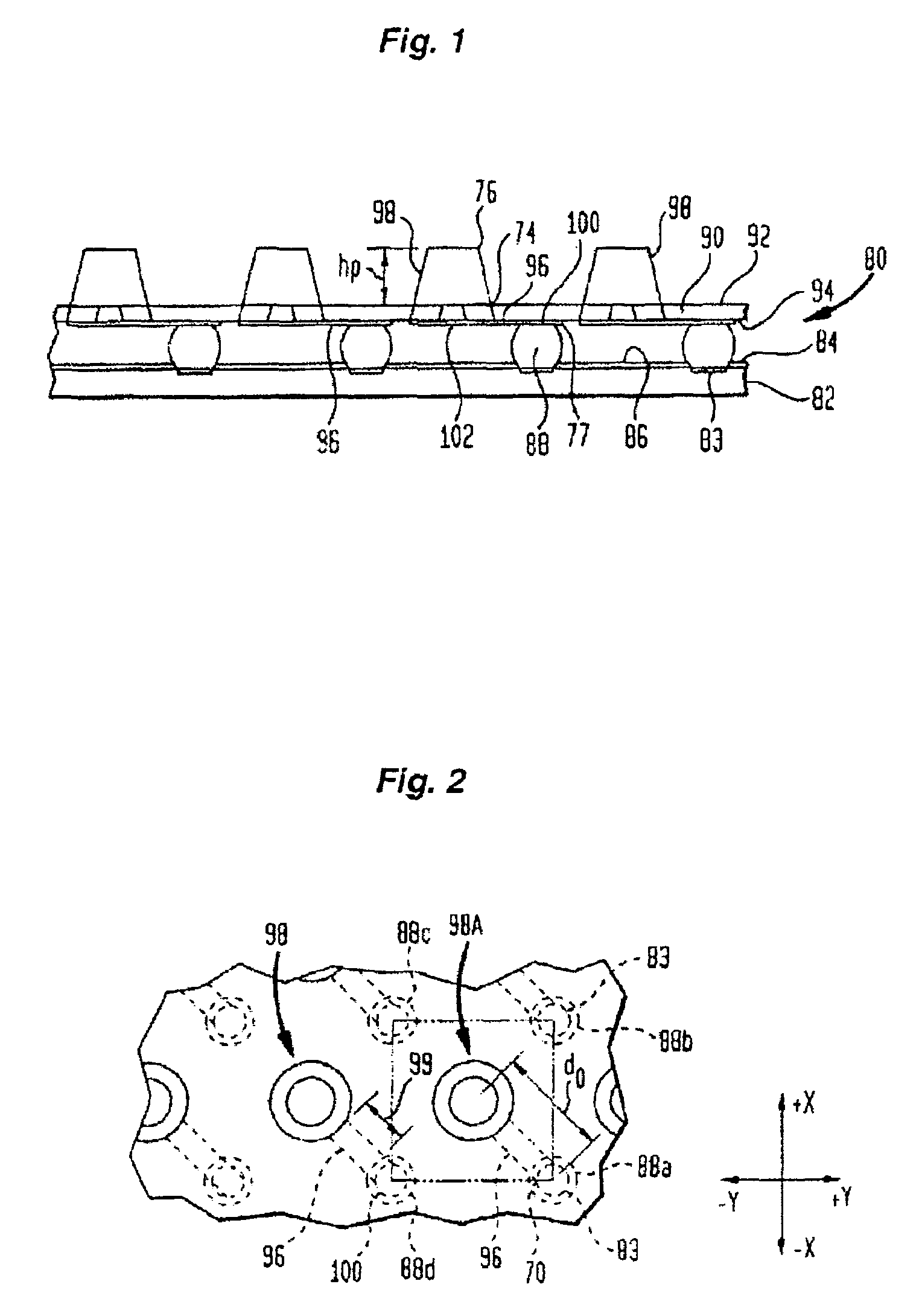 Microelectronic component with foam-metal posts