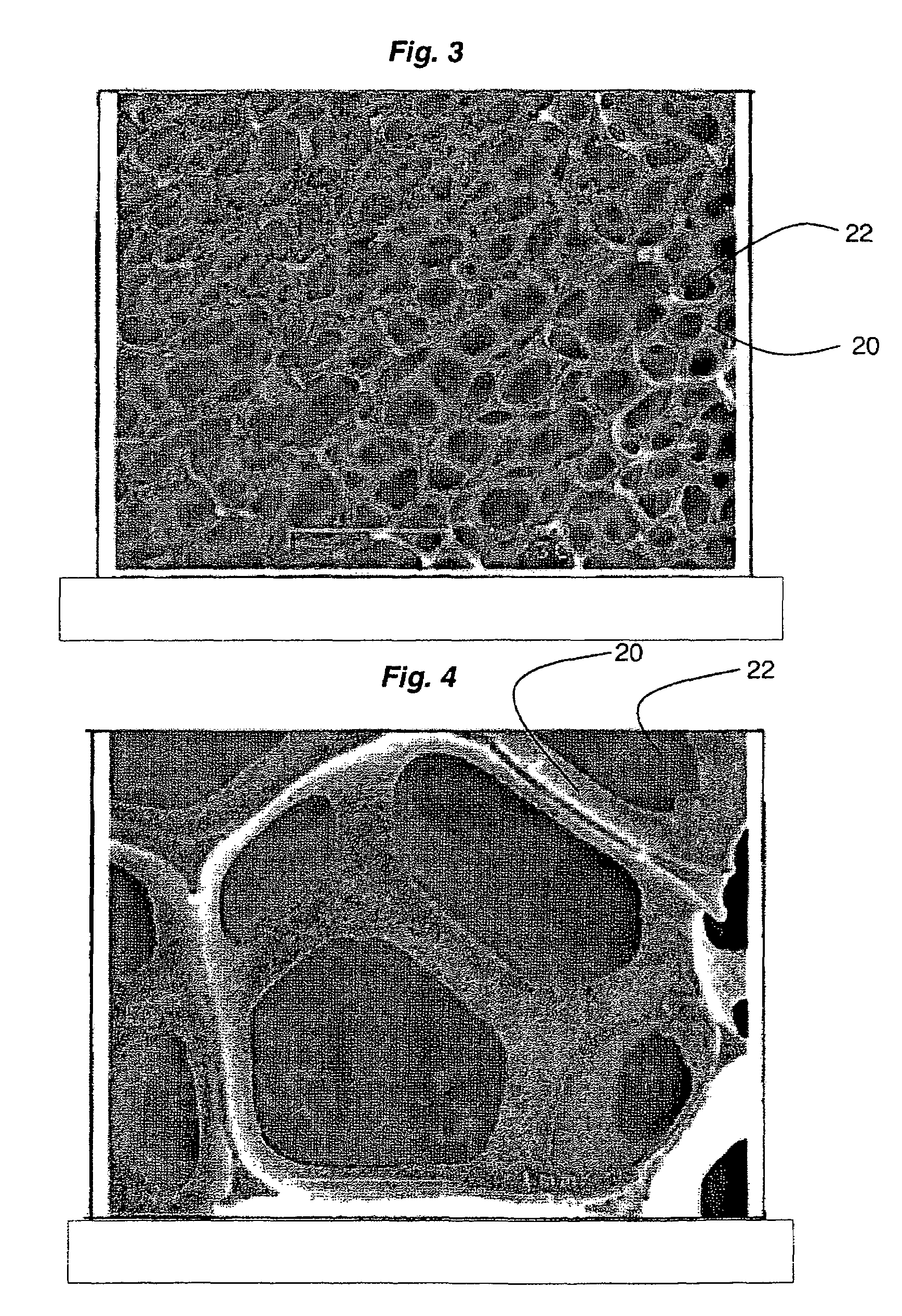 Microelectronic component with foam-metal posts