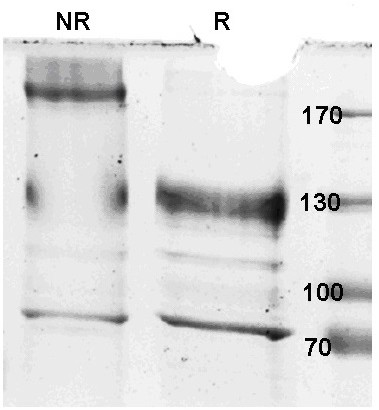 Interleukin-15 fusion protein for tumor targeting therapy