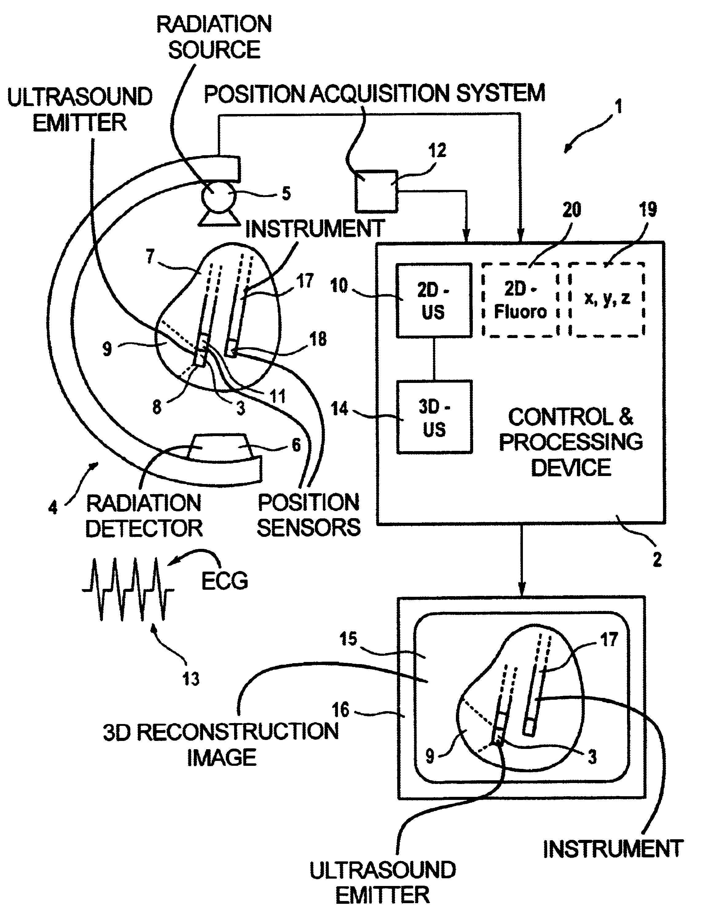 Method and apparatus for acquiring and displaying a medical instrument introduced into a cavity organ of a patient to be examined or treated