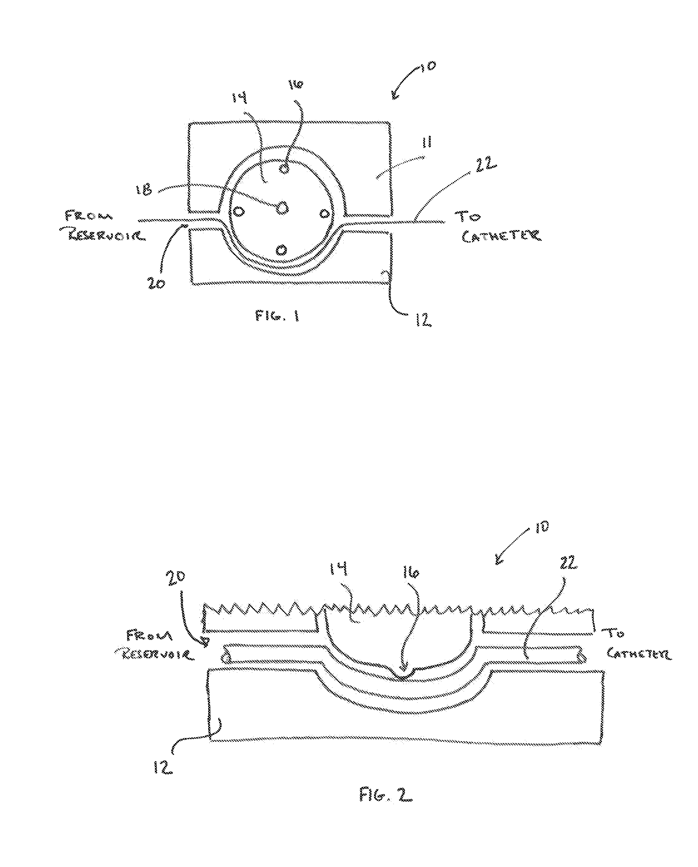 Devices and Methods for Reducing Electrical Noise in an Irrigated Electrophysiology Catheter System