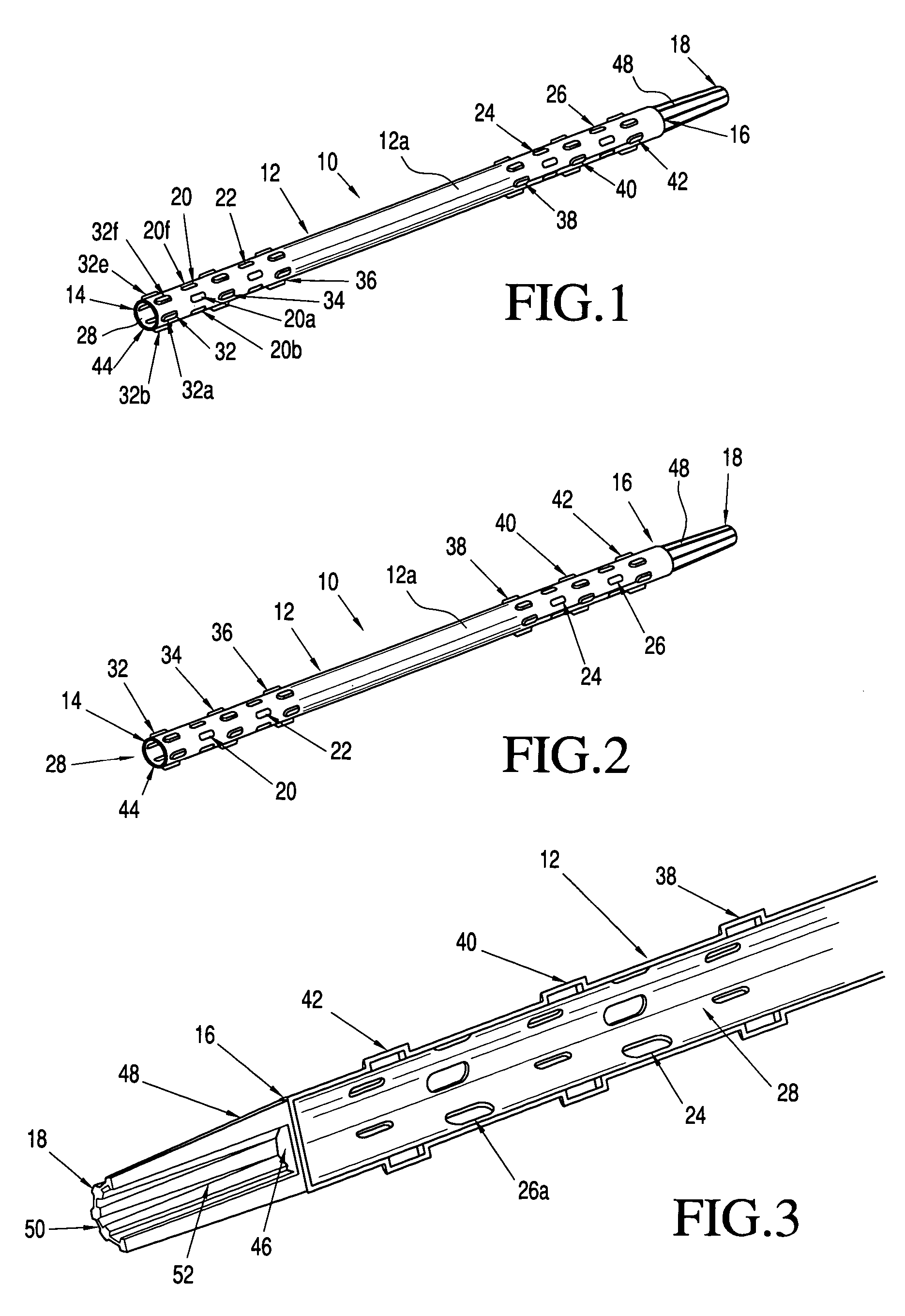 Masonry wall anchoring system