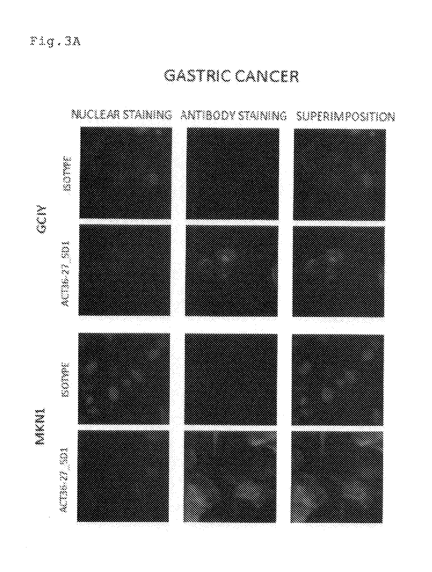 Antibody having Anti-cancer activity