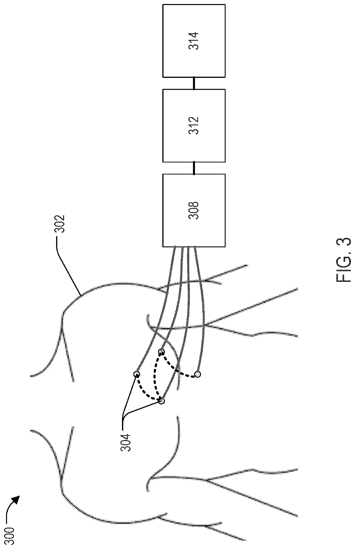 Systems and Methods for Controlling Imaging Artifacts Using an Array of Sensor Data