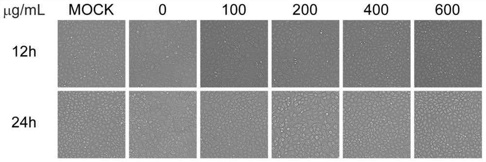 Application of plantain polysaccharide in preparation of anti-porcine pseudorabies virus infection preparation