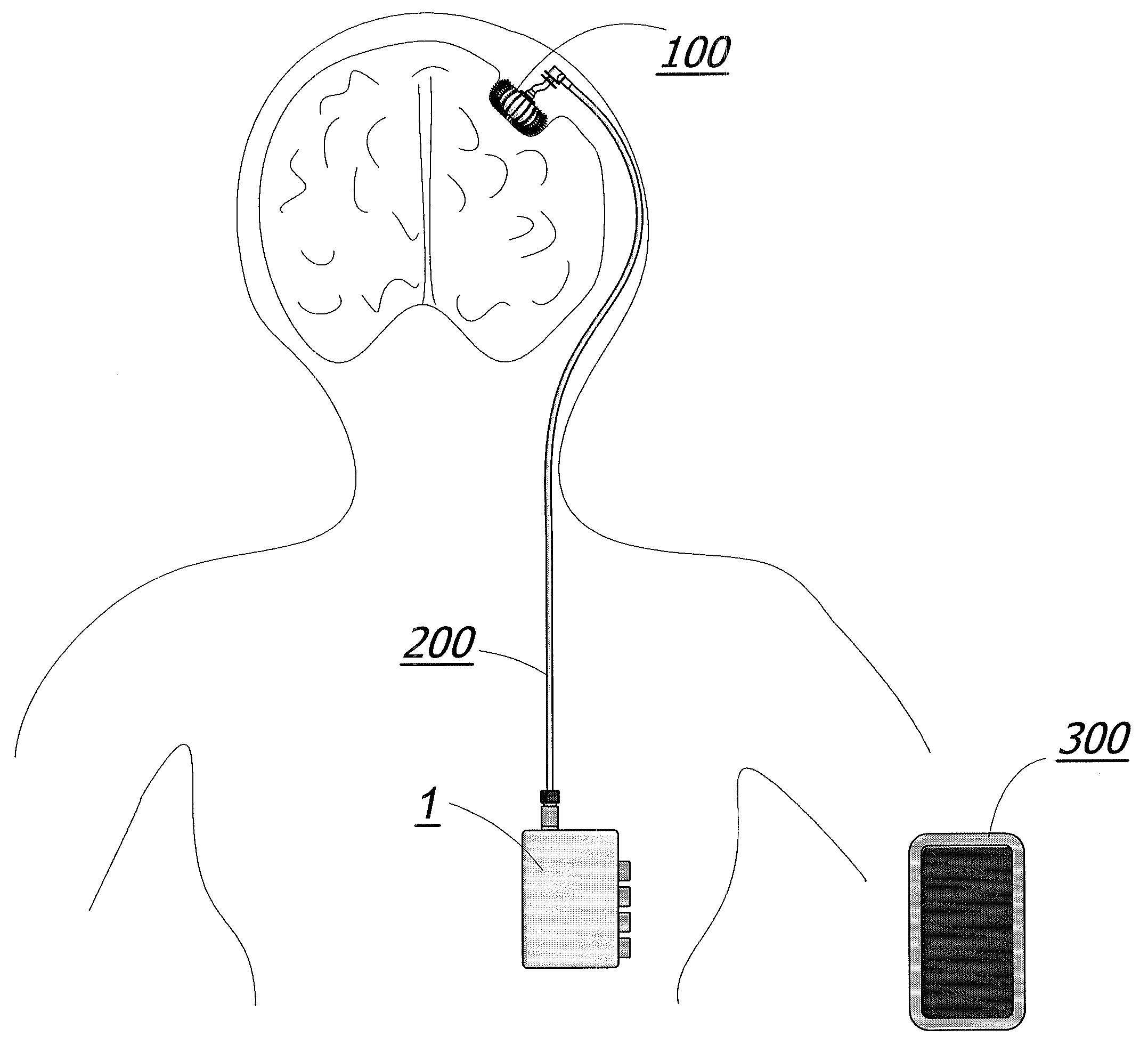 Magnetic Breather Pump and a Method for Treating a Brain Tumor Using the Same