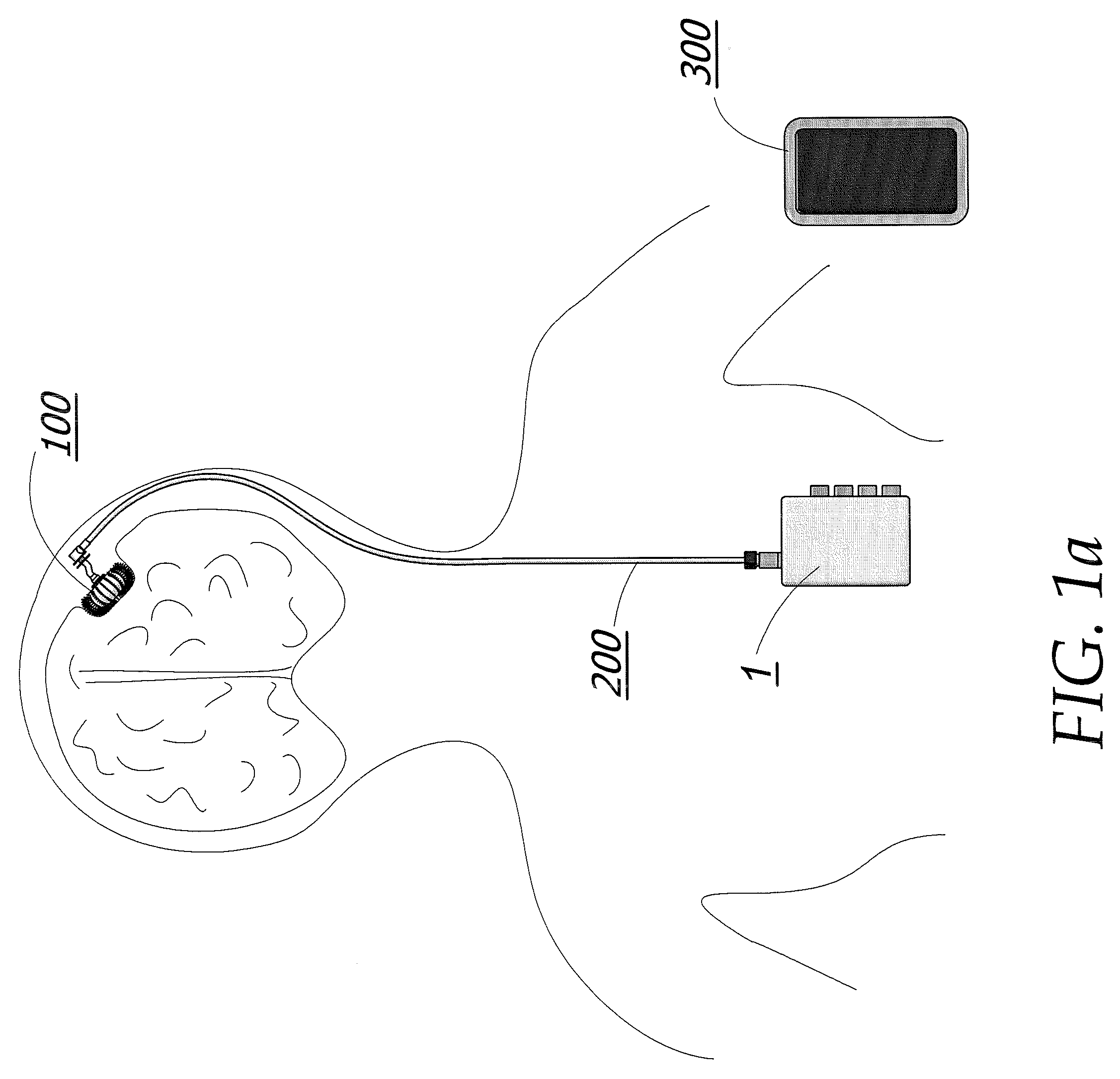 Magnetic Breather Pump and a Method for Treating a Brain Tumor Using the Same