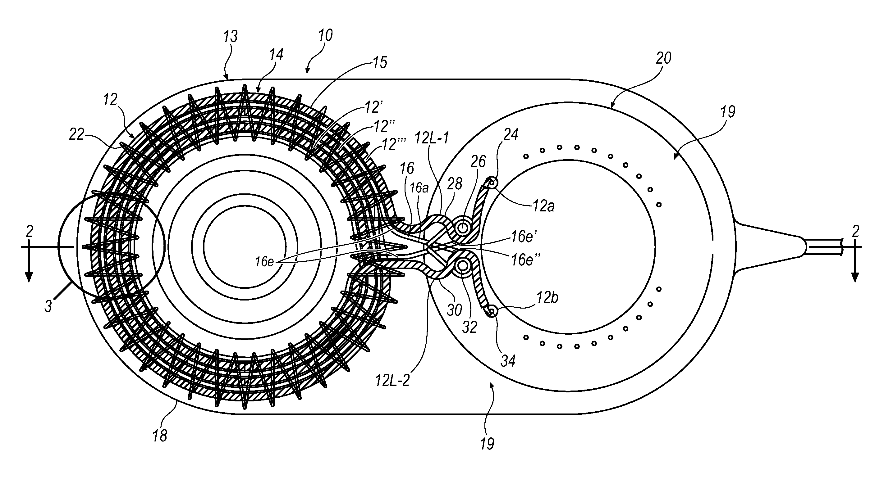 Impact resistant implantable antenna coil assembly