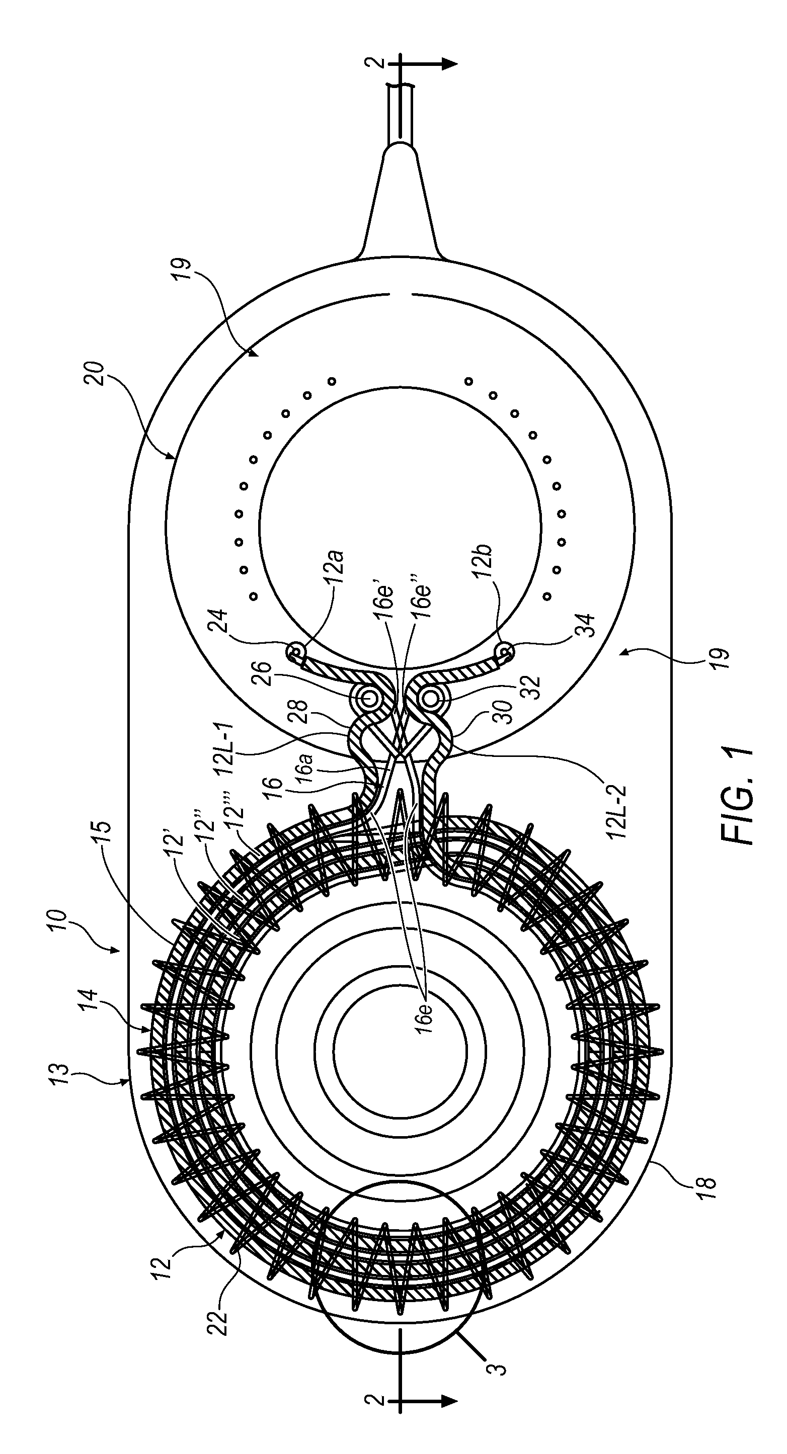 Impact resistant implantable antenna coil assembly