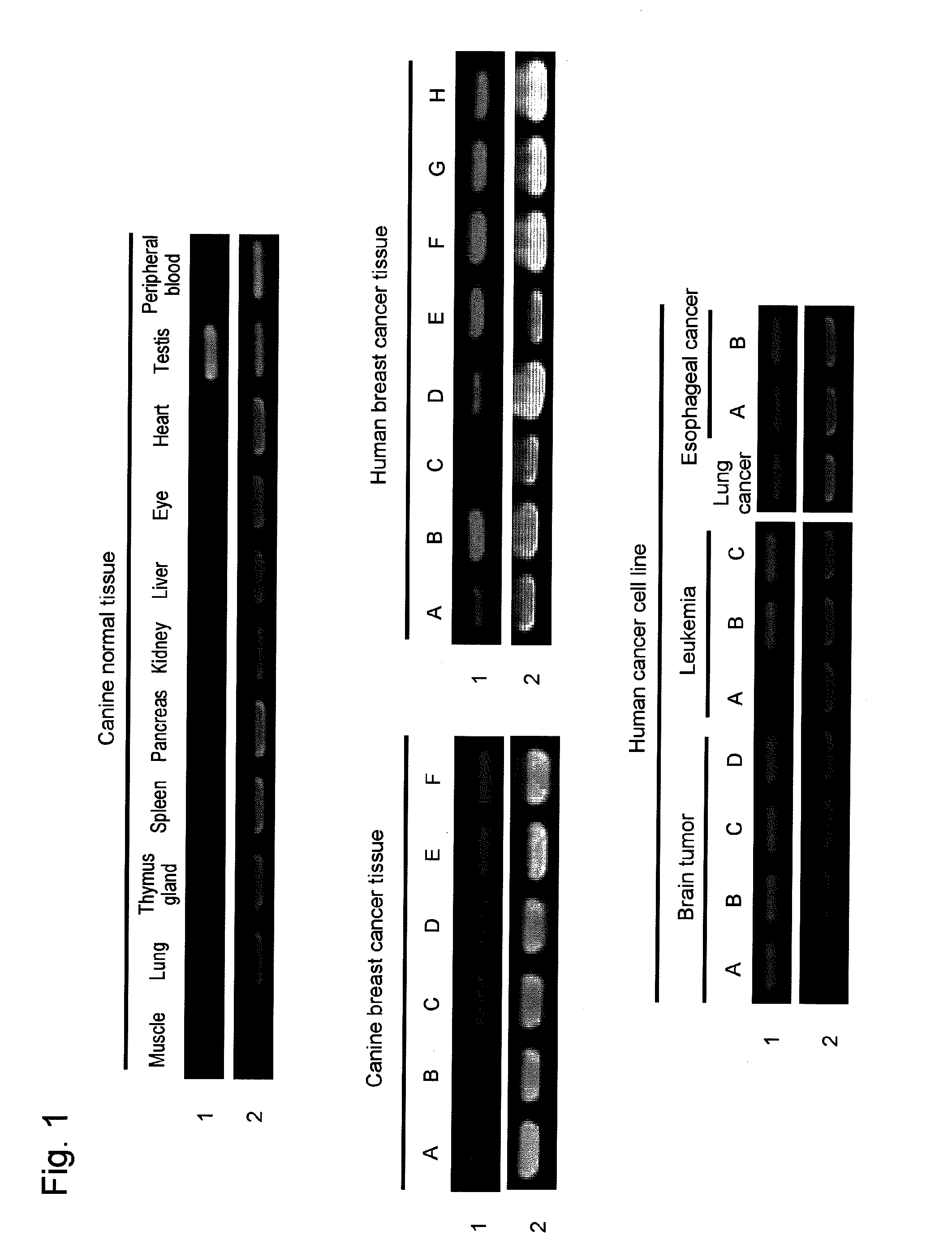 Pharmaceutical composition for treatment and prevention of cancers